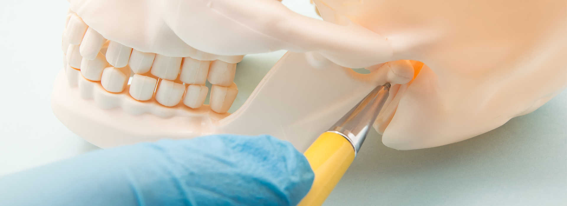 An image of a person s hand holding a small yellow object, possibly a toothbrush or dental tool, over a model human head with an open mouth. The background is white and nondescript.